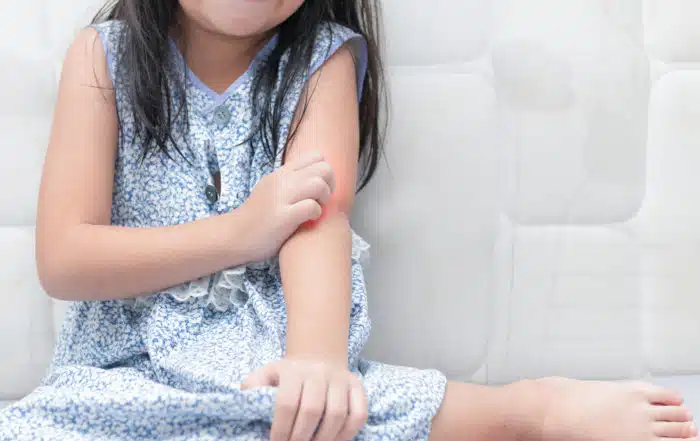 Little girl itching her arm