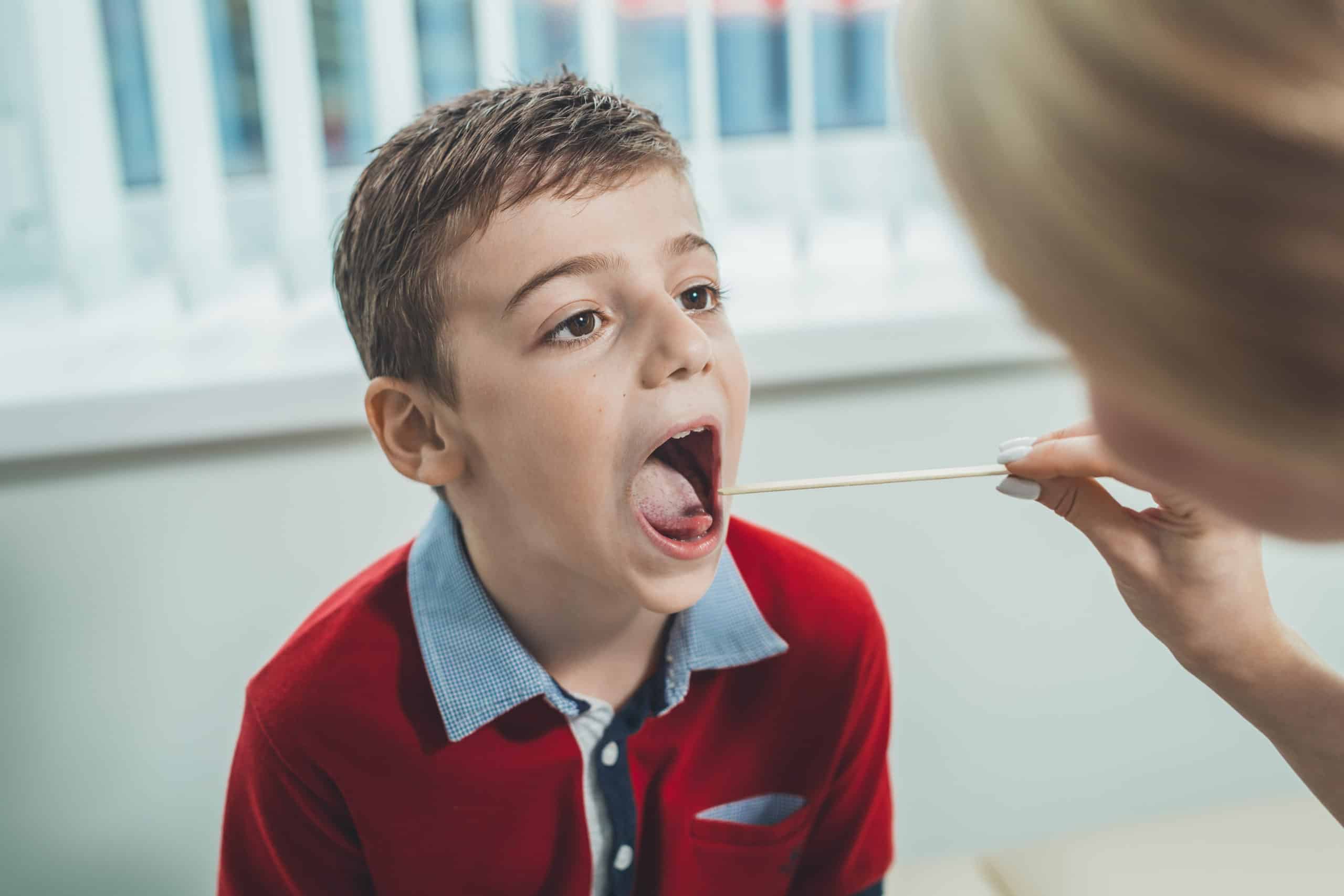 boy has strep throat. Children’s ENT doctor examines boy’s throat. Boy has strep throat. Children's ENT doctor examines boy's throat. Children's diseases, medical examination.