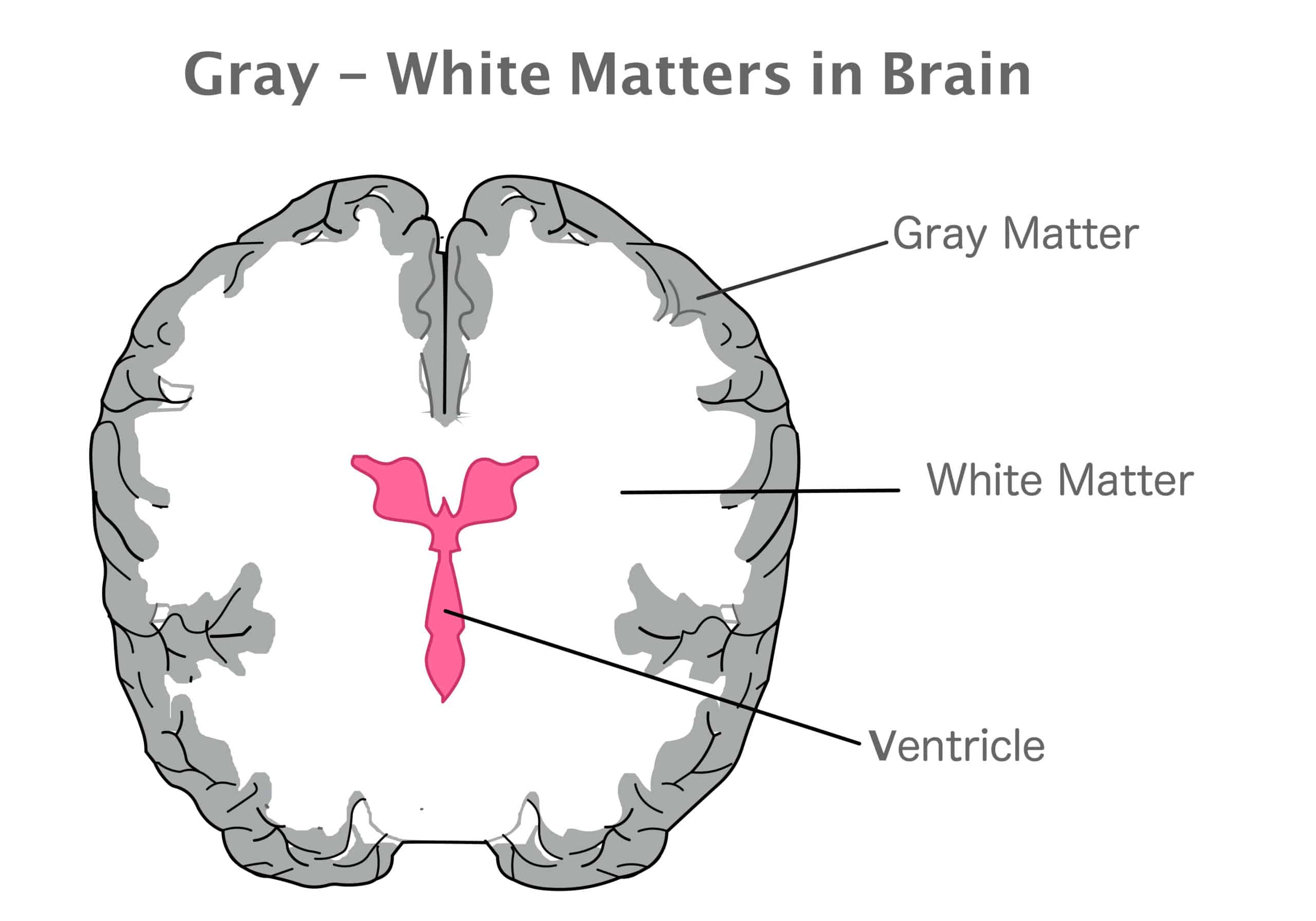 Gray matter, white matter, and ventricles in the human brain