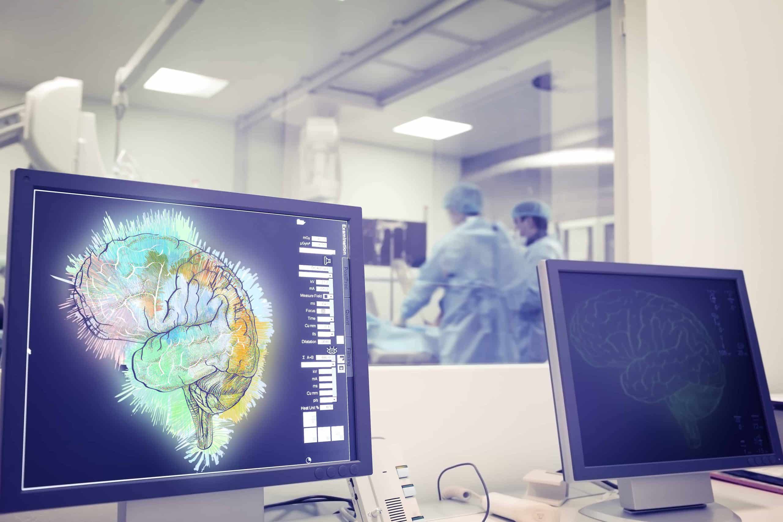 computer screens with brain scan on them