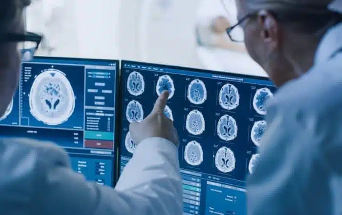 Doctors reviewing brain scan results on a monitor