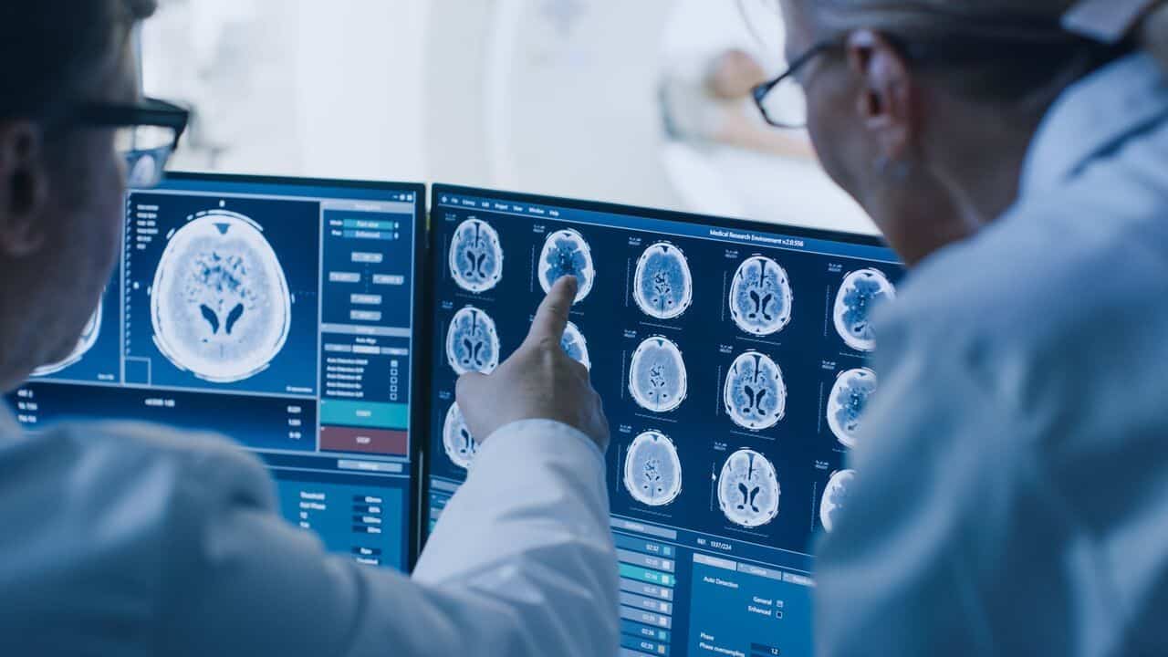 Doctors reviewing brain scan results on a monitor