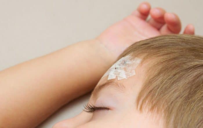 Child sleeping with a scar on the head