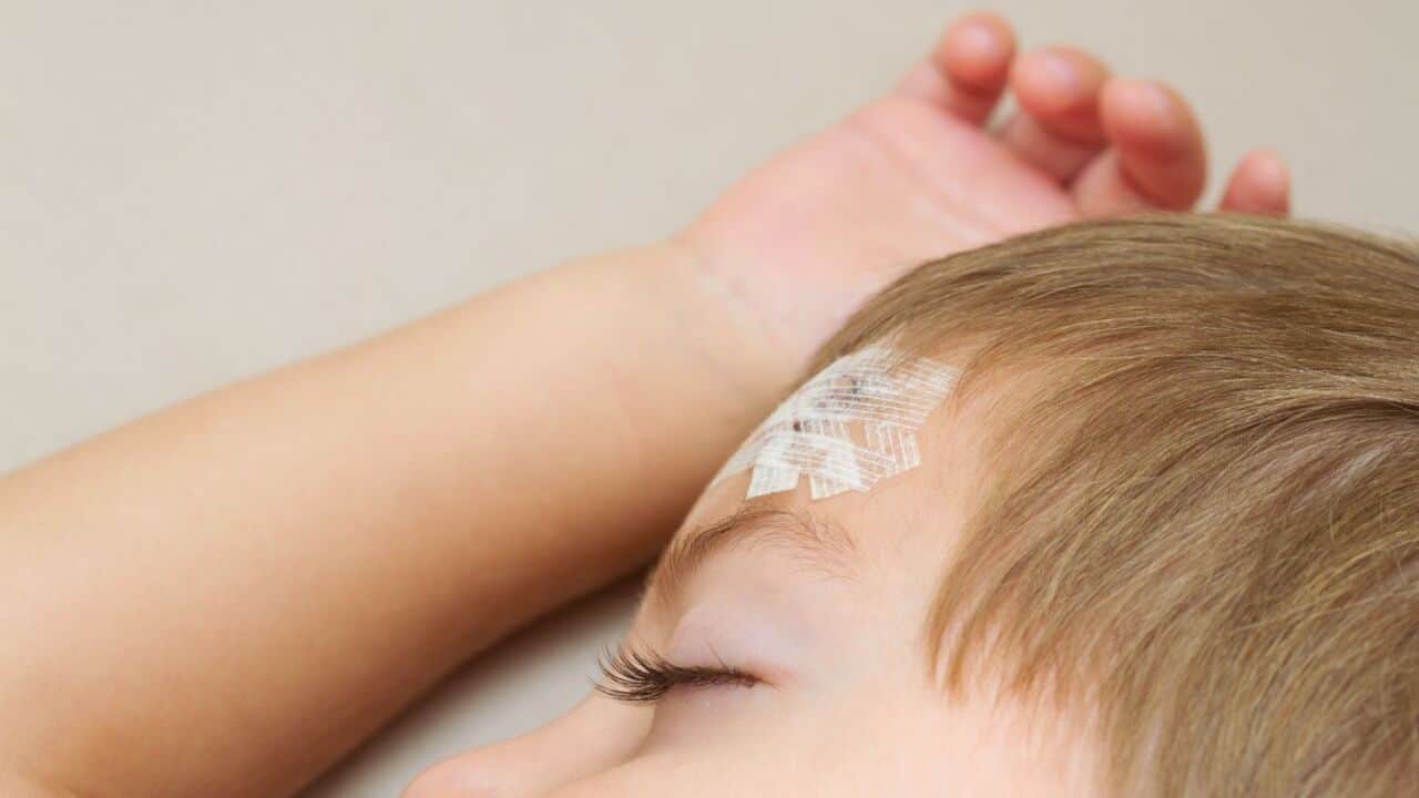 Child sleeping with a scar on the head